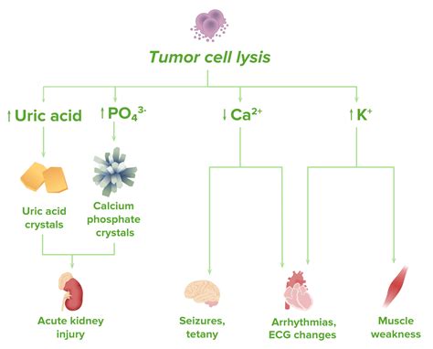 Tumor Lysis Syndrome | Concise Medical Knowledge