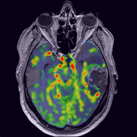 Image result for fMRI Python