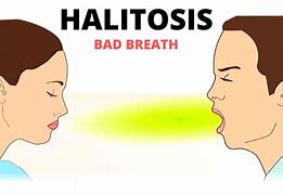 halitosis 的图像结果