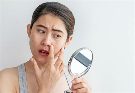 Pimple Inside Nose Painful