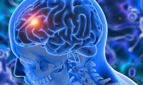 Prolonged use of certain hormone drugs linked to increased brain tumour ...