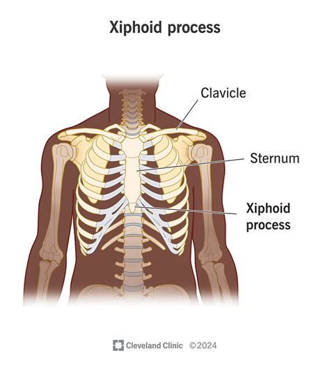 Xiphoid Process Problems 的图像结果