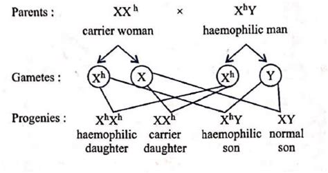 If a haemophilic man marries a carrier woman then which of the ...