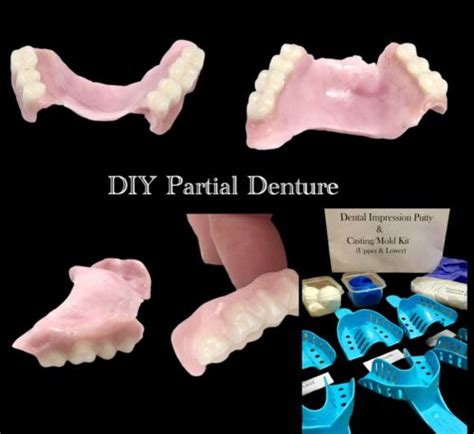 DIY Partial Denture Kit | Putty Dental Impression India | Ubuy