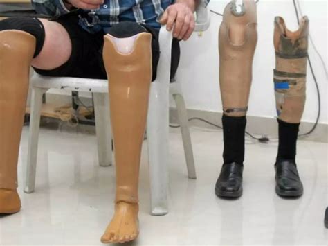 500 Specially-Abled People In Egypt Get 'Jaipur Foot' As India Helps ...