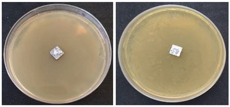 Calcium Hydroxyapatite Coatings: Low-Temperature Synthesis and ...