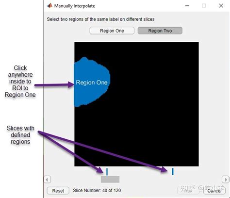 Image result for Volume Segmenter MATLAB Tutorial