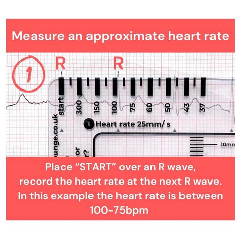 XRSP 2PCS ECG 7 Step Ruler, Plastic Ruler for ECG/EKG India | Ubuy