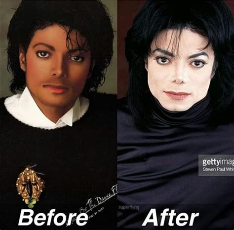 Michael Jackson After Plastic Surgery