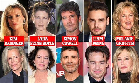 Kim Basinger Plastic Surgery Before After