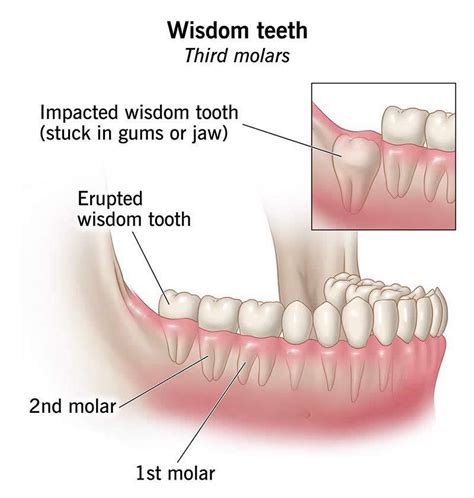 Wisdom Teeth Function 的图像结果