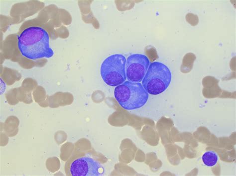 Normal Plasma Cell