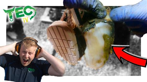 Image result for Abscess Explosion