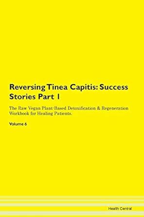 Reversing Tinea Capitis: Success Stories : Central, Health: Amazon.in ...