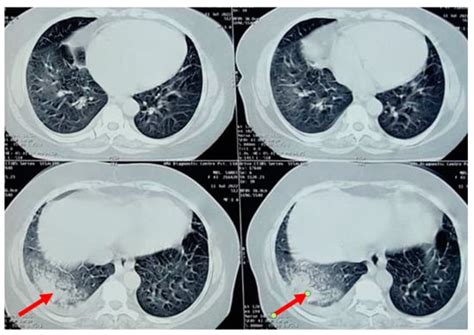 Journal of Respiration | An Open Access Journal from MDPI