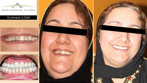 Dentist Near Me at GK 1 | Best Dentist in South Delhi