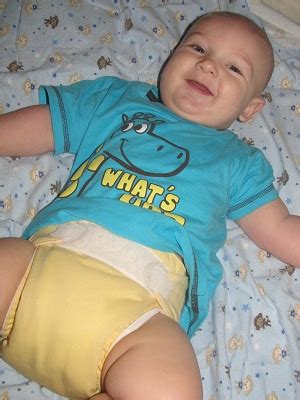 Image result for iPhone Auto Click Set Up