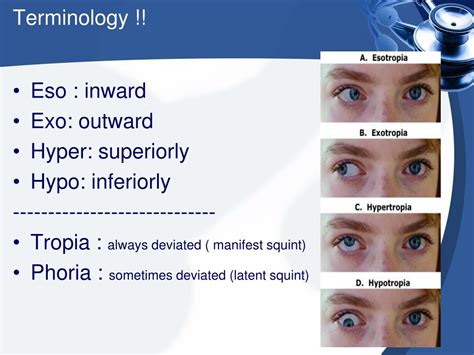 PPT - Strabismus PowerPoint Presentation, free download - ID:324782