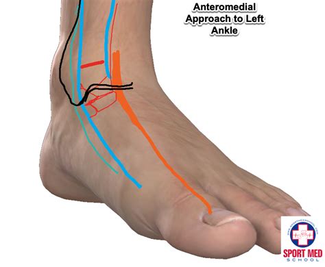 Image result for Ankle Anterolateral Approach Injection