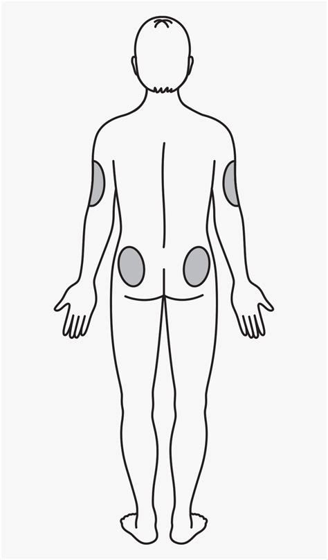 Injection Back Side 的图像结果
