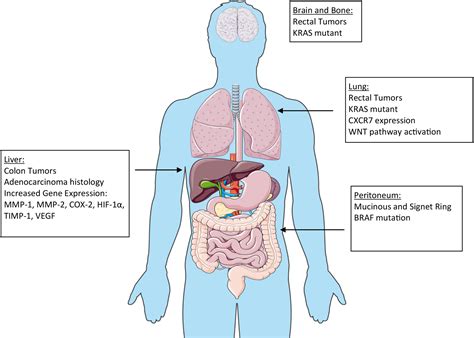 Surgical Treatment of Metastatic Colorectal Cancer - Surgical Oncology Clinics
