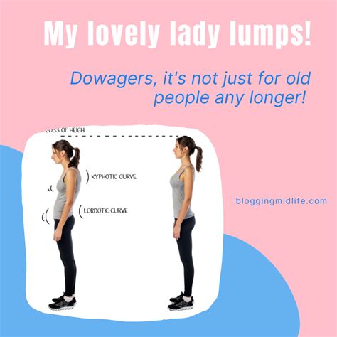 Dowagers hump, my lovely lady lump! - BLOGGING MIDLIFE