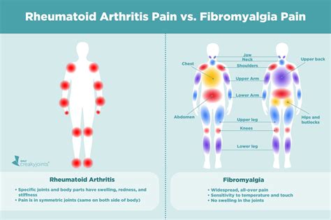 Causes of Rheumatoid Arthritis Pain Aside from Inflammation