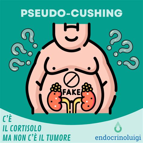 Pseudo-Cushing – Endocrinoluigi