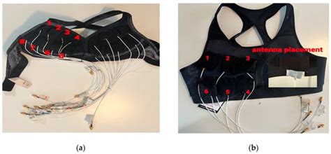 A Breast Tumor Monitoring Vest with Flexible UWB Antennas—A Proof-of ...