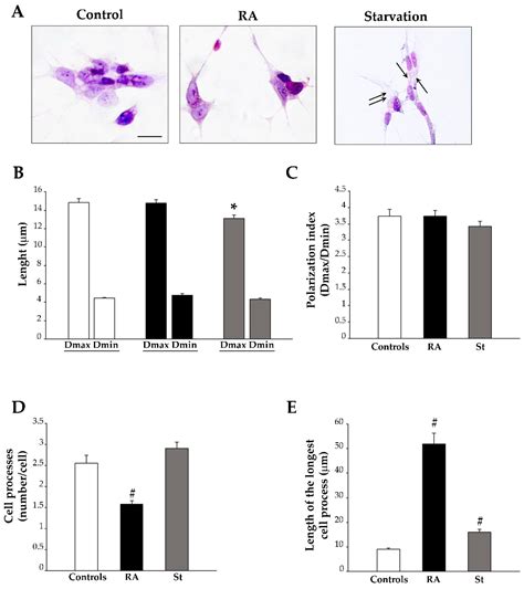 Retinoic Acid Promotes Neuronal Differentiation While Increasing ...
