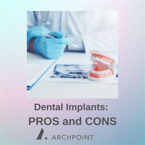 Pros and Cons: Dental Implants