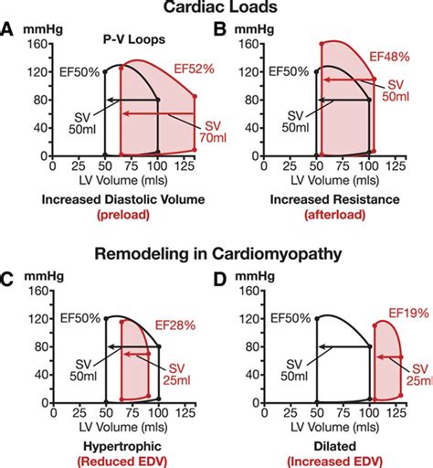Ejection Fraction | Circulation