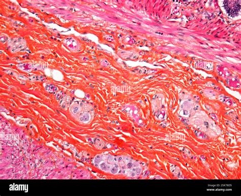 Light micrograph of a section through the wall of the large intestine ...