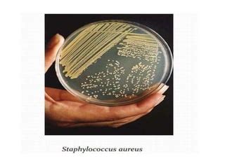 Image result for Staphylococcus Aureus Pathogenicity