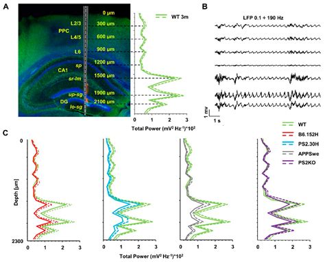 Dampened Slow Oscillation Connectivity Anticipates Amyloid Deposition ...