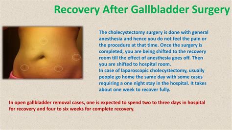 Surgery Recovery Time For Gallbladder