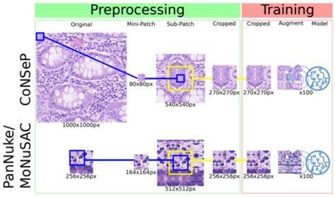 A Pragmatic Machine Learning Approach to Quantify Tumor-Infiltrating ...