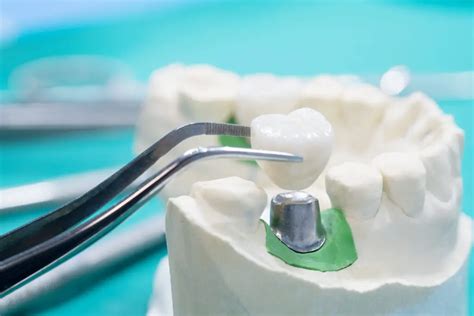 Image result for Tooth Hole