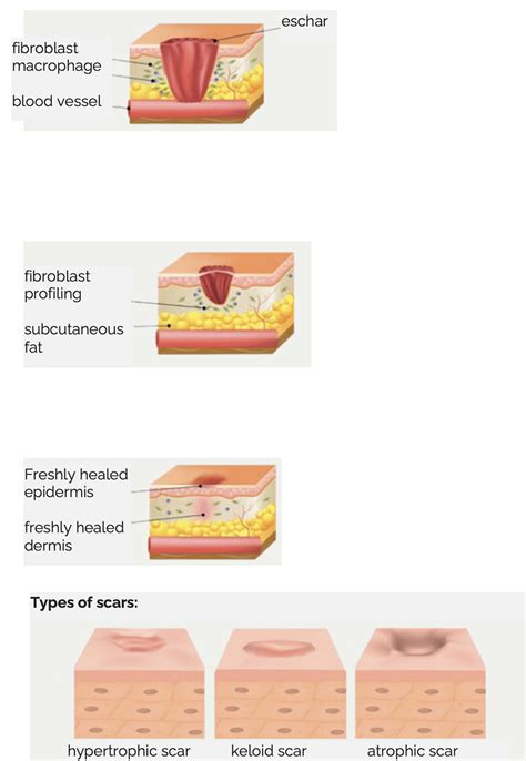 Wounds Become Scars - Dr. med. Schrammek Skincare