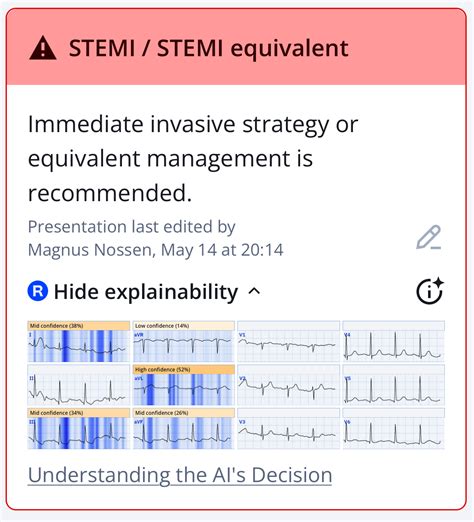 The diagnosis is NSTEMI, a worthless diagnosis which harms patients. - Dr. Smith’s ECG Blog