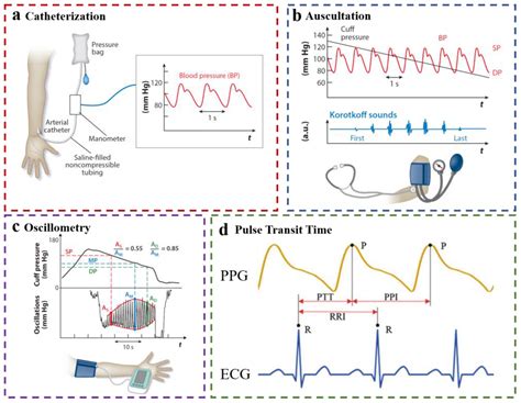 Wearable Continuous Blood Pressure Monitoring Devices Based on Pulse ...