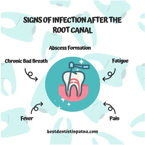 What Happens If You Get an Infection After a Root Canal?