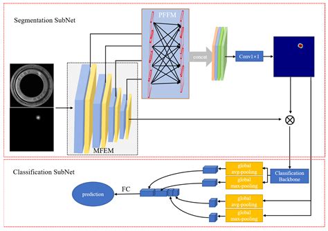 The Prior Model-Guided Network for Bearing Surface Defect Detection