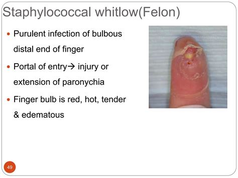 Staphylococcal & streptococcal skin infections | PPTX