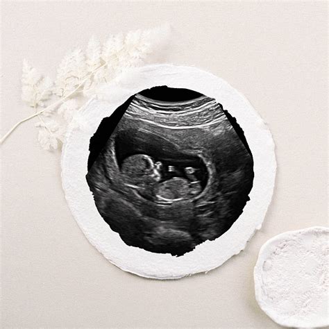 Nashville Ultrasound Services | 1st Heartbeat / Gender Reveal