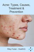 ACNE: TYPES, CAUSES, TREATMENT & PREVENTION | Casa del Libro