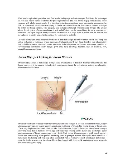 Information about Breast Biopsy | DOC