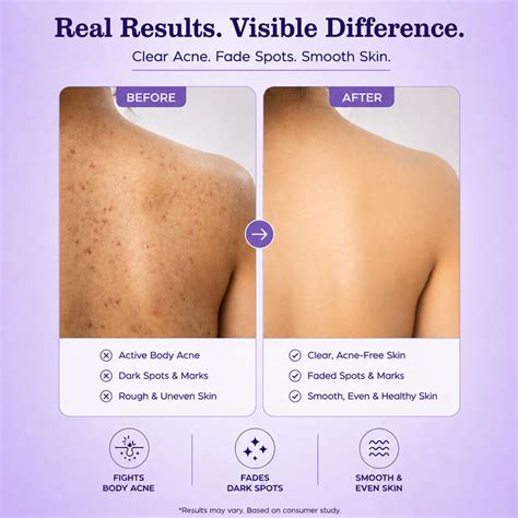 Dark Spots & Acne Clearing Body Wash – Sanfe