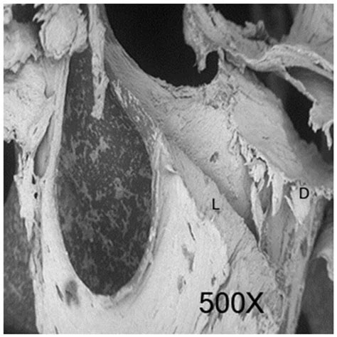 Comparative Investigation of Cutting Devices on Bone Blocks: An SEM ...