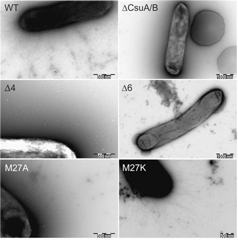 鲍曼不动杆菌 BNCCBNCC254392 微生物菌种|北纳生物